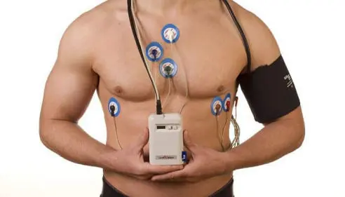 Holter de arritmia